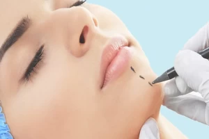 Image representing Plastic surgery department